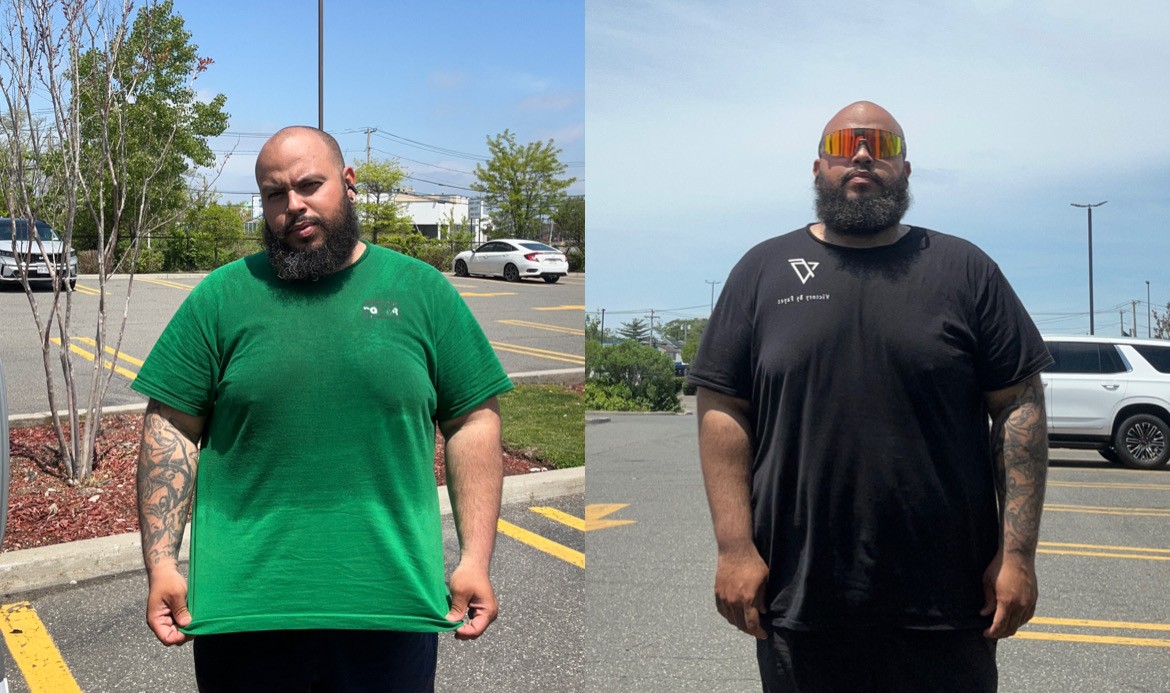 Fayez transformation — before and after, yerramazing